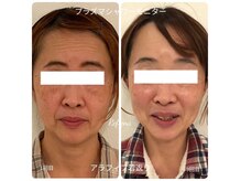 しみ改善サロン リフィーナの雰囲気（シミケアだけではない！色むら、くすみ肌質改善の美肌効果！）