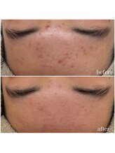 モンクラッシー(Mon classy)/