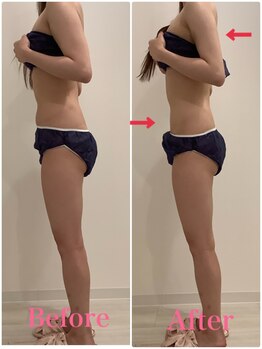 スペチアーレ 夙川/要らない脂肪はトイレに流す