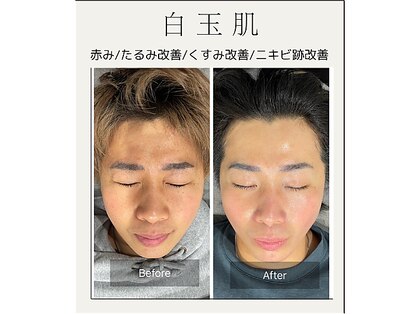 ドクターエイチ 麻布十番店(Doctor.H)の写真