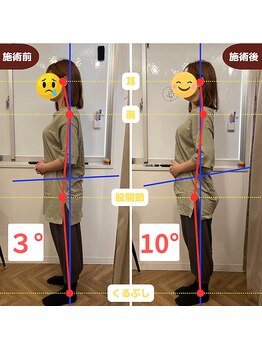 ふらっと/30代後半/会社員 肩こり/腰痛
