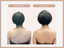 スリムライン 弘前店(The Slim Line)/before→after