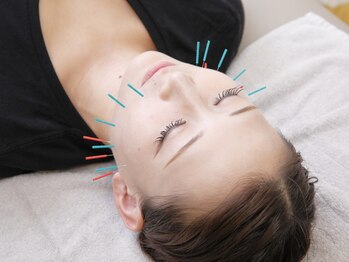 ネイビー鍼灸指圧治療院 那覇久米店(NAVY鍼灸指圧治療院)/美容鍼でハリのあるお肌へ★