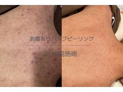 ライフ美容整体院 恵比寿(Life美容整体院)の写真