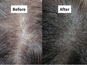 モンロー(MonroE+)/SMP(スカルプカラー)