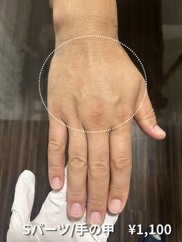 カナウ(KANAU)/【Sパーツ/脱毛】手の甲