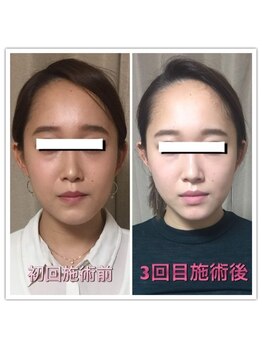 ラ アクサル(la.akthar)/小顔 全身 骨格矯正 整体