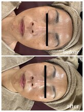 ジャスミン(Jasmin)/エステティック×シェービング