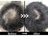 【より強い髪へ★】強髪プログラム(ヒト幹細胞培養液) HSC60 3回 ¥18,600