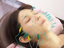 ポルクス鍼灸整骨院 表参道(Pollux鍼灸整骨院)/美容鍼灸