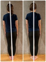 アメリオレ(ameliorer)/フェムケア矯正