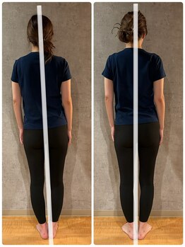 アメリオレ(ameliorer)/フェムケア矯正