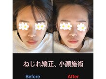 美容矯正サロン レレポノ(LELEPONO)/顔の捻じれ矯正