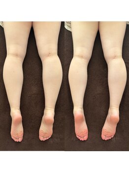 ケリービューティーサロン(kelly beauty salon)/浮腫み防止足マッサージ