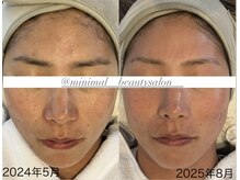 ミニマル(minimal)の雰囲気（続ける事で周りからも変化に気付いてもらえる方続出。）