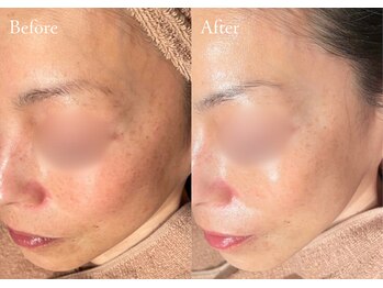 シューラディアント(ShuRadiant)/タラソトリートメント