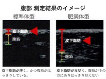 ジュリアン(Julien)/脂肪の厚みを測定[麹町]