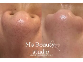 エムズビューティスタジオ エステ リラク 西川口店(M's Beauty Studio)/
