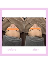 キワミビューティ(KIWAMI BEAUTY)/塗る金の糸/ビフォーアフター