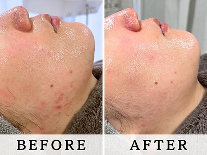 レヴィア(Revia)の写真