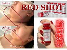 サロンフィーユ(Fille)の雰囲気（ポッチャリほほ/!顎下肉さよおなら!!!3～5回がオススメ☆）