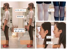 サンテリア(Santelia)の雰囲気（顎の問題や食いしばりのお悩みも多数！猫背/反り腰/骨盤の歪み♪）