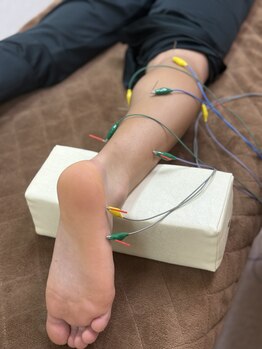 ともや鍼灸院の写真/【走りを快適に！鍼灸でボディーメンテナス＆痛みのケア◎】☆市民ランナーを応援します！