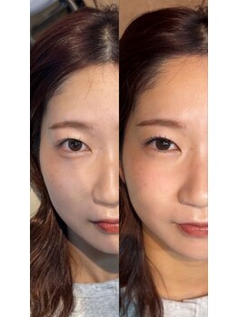 カラン バイ ソーイ アンド メイクアイ ラトット バイ ソーイ アンド メイクフェイス/LED フラットラッシュ