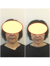 やち鍼灸院/人気の小顔整体！