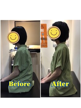 くすの樹接骨院 整体院 町田院/整体/骨盤矯正ビフォーアフター