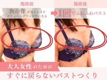 ベルフルール/バストアップ/熊本/南熊本