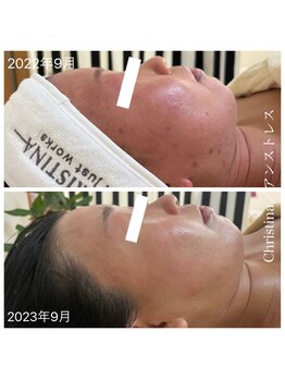 ルルボーテ(Loulou Beaute)/クリスティーナ/アンストレス