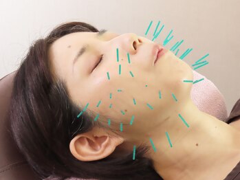 ポルクス鍼灸整骨院 表参道(Pollux鍼灸整骨院)/美容鍼灸