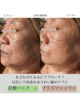 トリニティスペース(TrinitySpace)/ハーブ×プラズマ×炭酸パック