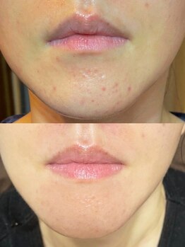 ユウビ ビューティー サロン(Yuubi)/