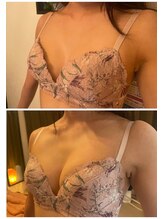 美人バスト 福岡店/バストアップ ◇症例◇