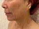 ナンバー19(N°19)の写真/お肌の悩みを解消するエステサロン！ホウレイ線・たるみ改善で、50代・60代のお客様にも大人気◎