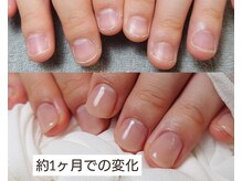 インプルーヴ(improve)の雰囲気（早い方は1ヶ月で実感★ジェルで補強しながら自爪を育てます♪）