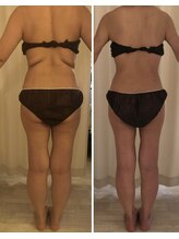 ルラシェ/ブライダルエステ