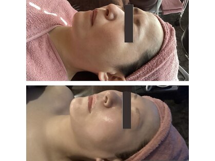 ブリス(bliss)の写真