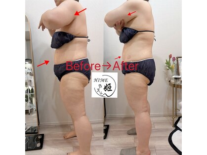 ヒメ ビューティー(Hime beauty)の写真