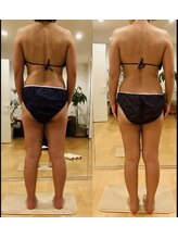インフィニート(∞)&nbsp;姿勢　 矯正