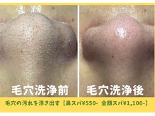 ビービー(BB)/Before→after