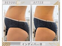カリド ラボ(CALIDO LAB)の雰囲気（1回で引締めOK！【インディバ/リンパマッサージ/フェイシャル】）