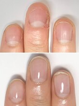 リモネイル(Rimo nail)/爪育成　クリア仕上げ