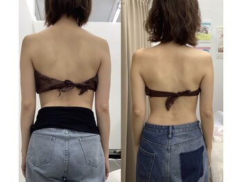 メリアミーゴ(Meli amigo)/30代女性 肩こり改善