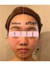 《1回でこの効果》小顔たるみケア♪リフティングコース70分￥5,800→￥5,000