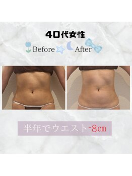 美 ワン(美 one)/痩身ダイエット