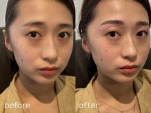 オムズアイ(om's eye.)/HBL×ラッシュリフト