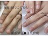 【深爪矯正】ご新規様自爪育成トータルケアメニュー